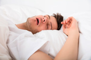 metodi per non russare